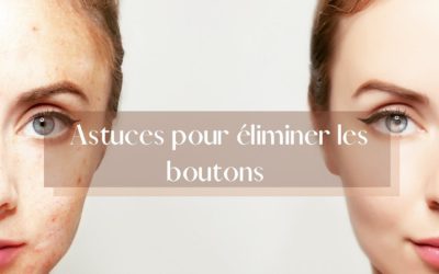 Savoir comment se débarra…