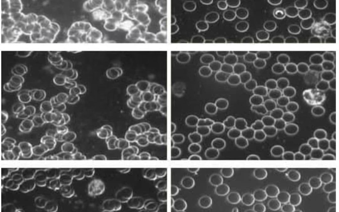 Les bienfaits de la mise à la terre et l’impact sur la viscosité sanguine !