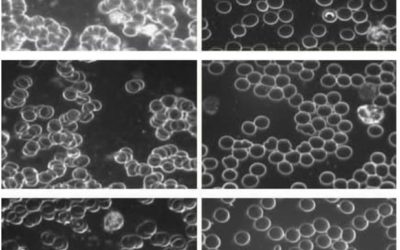 Les bienfaits de la mise à la terre et l’impact sur la viscosité sanguine !