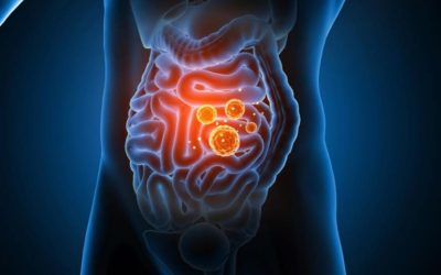  Tu as déjà entendu parler de l’intestin perméable